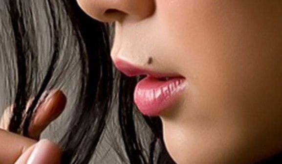 Những nốt ruồi quan trọng nhất định phải giữ lại vì đó là quý tướng của bạn